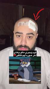 Tom Và Jerry Chết