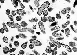 Fiebre q, otra zoonosis poco frecuente. Coxiella Burnetii Wikipedia La Enciclopedia Libre