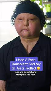 Reconstructive Surgery After Car Accident