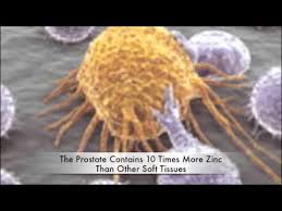 If you've received a diagnosis, here are some things you need to know about the condition. How Zinc Fights And Prevents Cancer Youtube