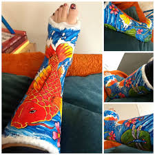 Painted Cast Koi Cherry Blossom Lotus Flower In Acrylic On A Broken Leg Cast Decoration Broken Leg It Cast