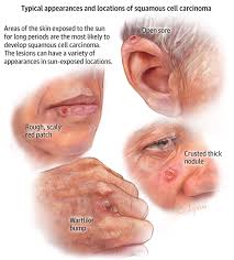 Pin On Patient Information Pages