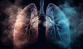 Study reveals how patients' smoking history changes evolution of lung  cancer | WEHI