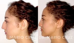 Dr Mario Cruz Cirujano Plástico Ibagué