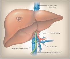 Image result for Transplantation