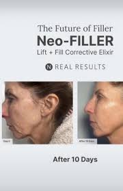 Tonight you are invited to hear all new information