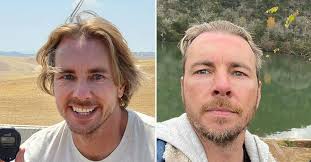 By signing up, i agree to the terms and privacy policy and to receive emails from. Did Dax Shepard Get Plastic Surgery Experts Discuss His Fresh Look