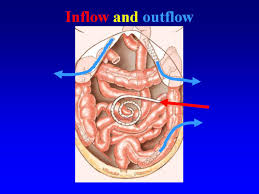 Despite many histopathologic similarities between peritoneal and . Hipec Ovhipec Pmp Peritoneal Cancer Peritoneum Seeding Seedings Metastases Hyperthermic Intraperitoneal Chemotherapy Debulking Colon Colorectal Ovarian Ovary Mesothelioma Pseudomyxoma Appendix