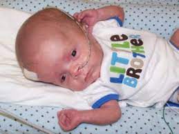 4 Tips For Raising A Child With Hydrocephalus Hand To Hold