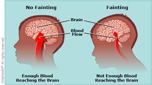 His symptoms may resemble some symptoms of migraine. A To Z Symptom Fainting For Parents Nemours