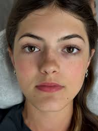 Mackenzie Calvert (@kenzie_esthetics) • Instagram photos and videos