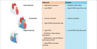 Image result for Preload