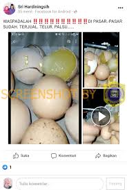 Gigi palsu penuhgigi palsu penuh adalah gigi palsu yang menggantikan semua gigi asli dan struktur tisu berkaitan pada rahang atas dan bawah. Salah Telur Palsu Beredar Di Pasaran Turnbackhoax Id