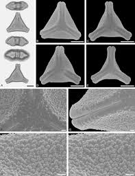 Image result for Actinanthella