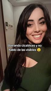 Chicas Que Tienen Cicatriz En La Frente