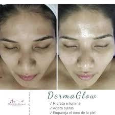 EspacioPublicitario Alejandra Roman ¿Piel desvitalizada, agredida por el  sol y con falta de luminosidad?😨🥹 No problem!!🌚🌝 ✨Derma Glow✨ es para  ti 🙌 el tratamiento estrella en nuestro consultorio que le dará luz