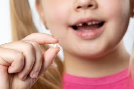 Mimpi gigi atas lepas semua. Paling Ditakuti Inilah Arti Mimpi Jika Semua Gigi Copot Dan Rontok Bisa Jadi Akan Menghadapi Masalah Keuangan Hingga Pekerjaan