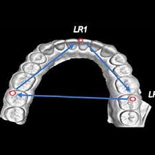 The effect of operator scanning speed