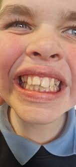 Huge thank you to the fantastic staff at St Conals Dental department today  Simon, Lynn, Nicole & Dr Asin Oisín fell yesterday at school and broke MORE  off his already broken front