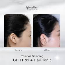 Esther Aesthetic Clinic Denpasar (@esther.denpasar) • Instagram photos and  videos