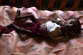 نتيجة بحث الصور عن الإيدز