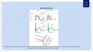 Image result for Early Repolarization