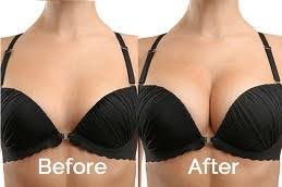 Fat Transfer Breast Augmentation in Dubai Cost | Price's & Offers