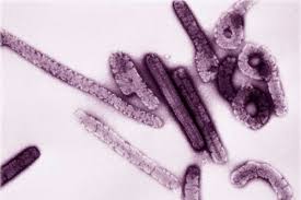 Jun 29, 2021 · redacción. Detectan Virus De Marburg En Sierra Leona Biotechmn