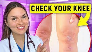 ORA Orthopedic specialist, Dr. Ryan Pokorney, explains four common reasons  for joint pain.