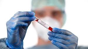 Es wird ein abstrich aus. Verdacht Auf Betrug Bei Einem Pcr Test Labor Betreiber Aus Berlin Ermittungen Der Staatsanwaltschaft Schleswig Holstein Rbb24
