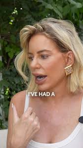 I will never regret my facelift🙂