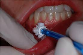 Oral biopsy aims to obtain clear and safe diagnosis; Oral Pathology Techniques For Detection And Differential Diagnosis Cdeworld March 2018 Cdeworld