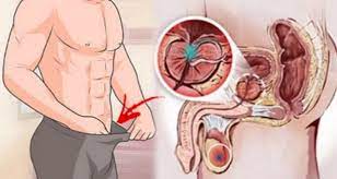 What are the warning signs of prostate cancer? Early Warning Signs Of Prostate Cancer Your Guide To Health Wealth