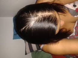 Langhaarfrisuren sehen oft kraftlos aus und hängen platt am kopf herunter. Haarausfall Oder Nur Dunnes Haar Gesundheit Und Medizin Gesundheit Ernahrung