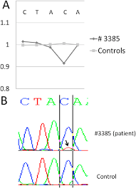 Sequencing Analysis Of The C 808c T P Gln270 Mutation In Nf1 Gene Download Scientific Diagram