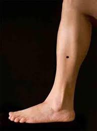 Impact Of Body Moles On Your Life Body Mole Meaning Rgyan impact of body moles on your life