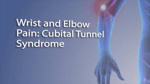 Cubital Tunnel Syndrome Johns Hopkins Medicine