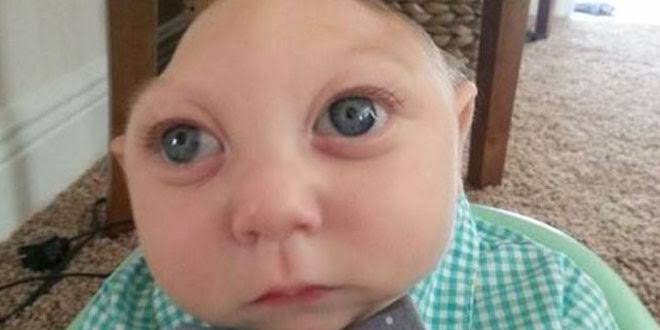 The courage and hope of Jaxon Strong - HTV