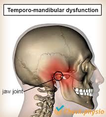Image result for Jaw Claudication