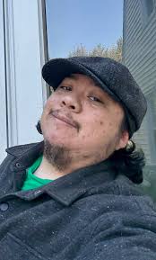 Transitioning experience and top surgery benefits