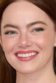 Oscars 2024: The Best (And Worst) Celebrity Hair and Makeup Looks