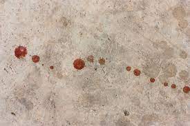 Check spelling or type a new query. Nettoyer Des Taches De Sang Sur Cuir Terre Cuite Ou Carrelage