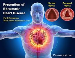 Prevention Of Rheumatic Heart Disease Heart Disease Prevention Heart Healthy Meals Plan Disease Prevention