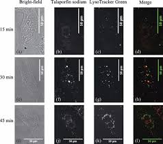 Image result for Porfimer