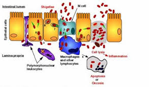 Image result for Shigella