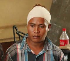 $50,000 bail for man who lashed "bully" to head during drunken row