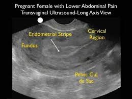Pin On Sonography Radiology