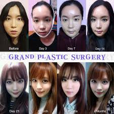 グランド整形外科病院さんはinstagramを利用しています 皆さん おはようございます 朝から雨ですね チヂミが食べたい日です 美容整形 美容 病院