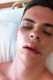 Australian Jack Hansen-Bartel a victim of Thailand's brutal underbelly