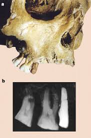 Fan de made in france, je privilégie depuis des années des marques et des produits made in france. False Teeth Of The Roman World Nature